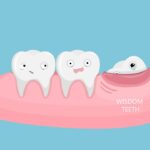 5 Signs You May Need Wisdom Teeth Removal